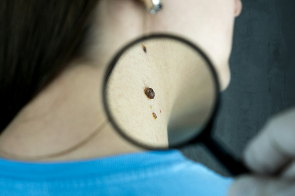 Dermatologia